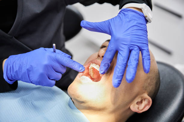 Best Emergency Gum Treatment in Pamplico, SC
